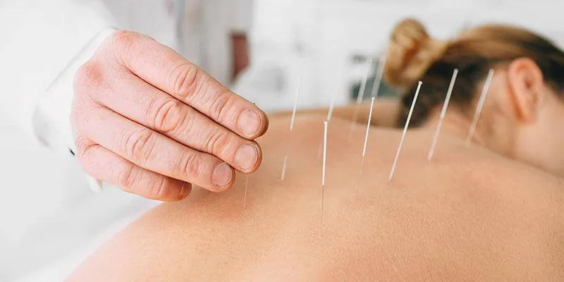 RUaWJbm-2 what does dry needling help