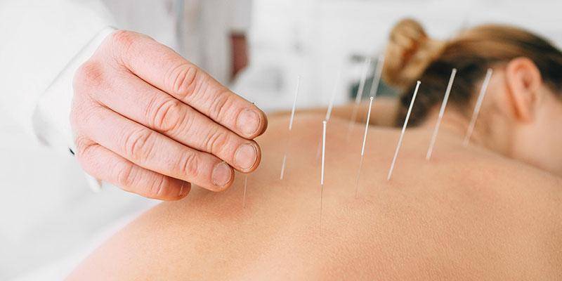 what does dry needling help
