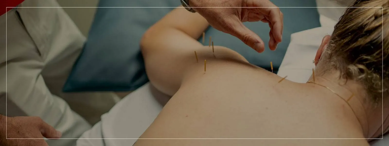 baWT0E4-2 can dry needling make pain worse