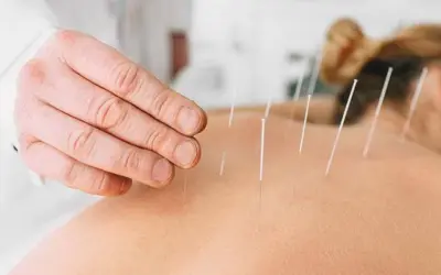 what does dry needling help