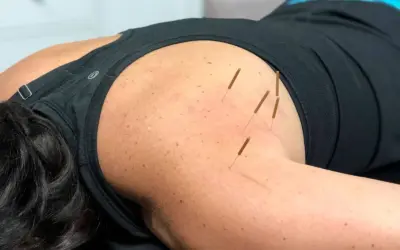 can dry needling cause more pain