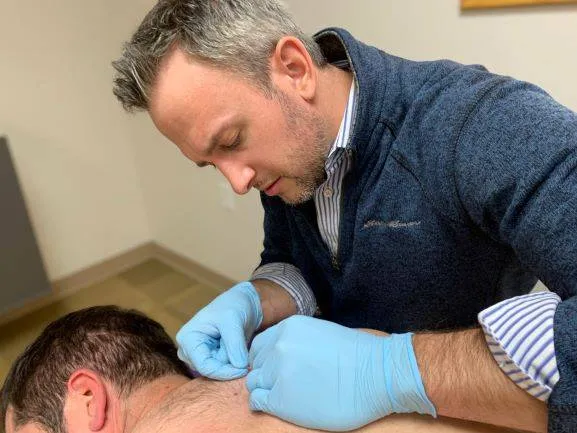 often dry needling