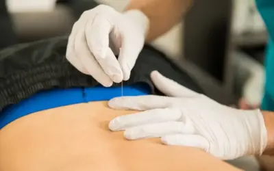 Can You Dry Needle Hip Flexors?
