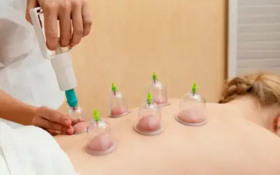 The Dangers of Cupping: What You Need to Know Before Booking a Session