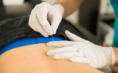 How Does Dry Needling Help?