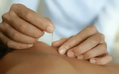 What should you not do after dry needling?
