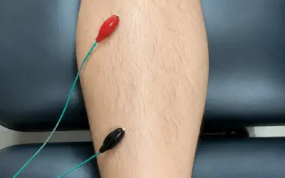 Why do I feel worse after dry needling?