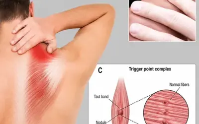 Can dry needling cause diarrhea