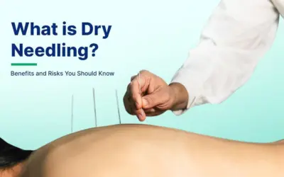 How long do effects of dry needling last?