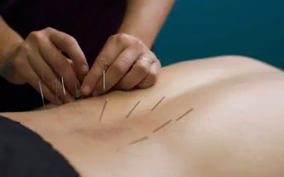 Does dry needling help inflammation?