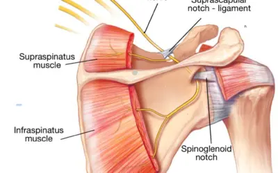 Do they numb you for dry needling?
