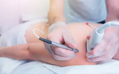 Is massage or dry needling better?