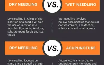 What is better than dry needling?