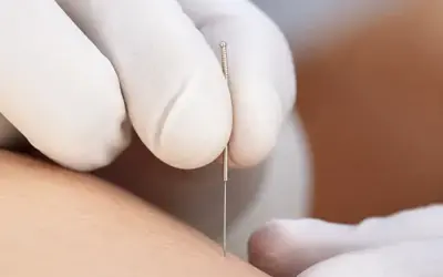 How effective is dry needling?