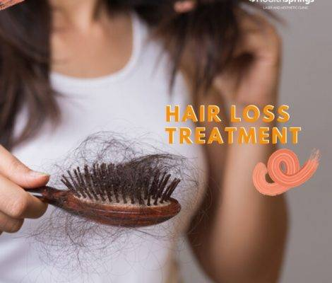 hair loss treatment